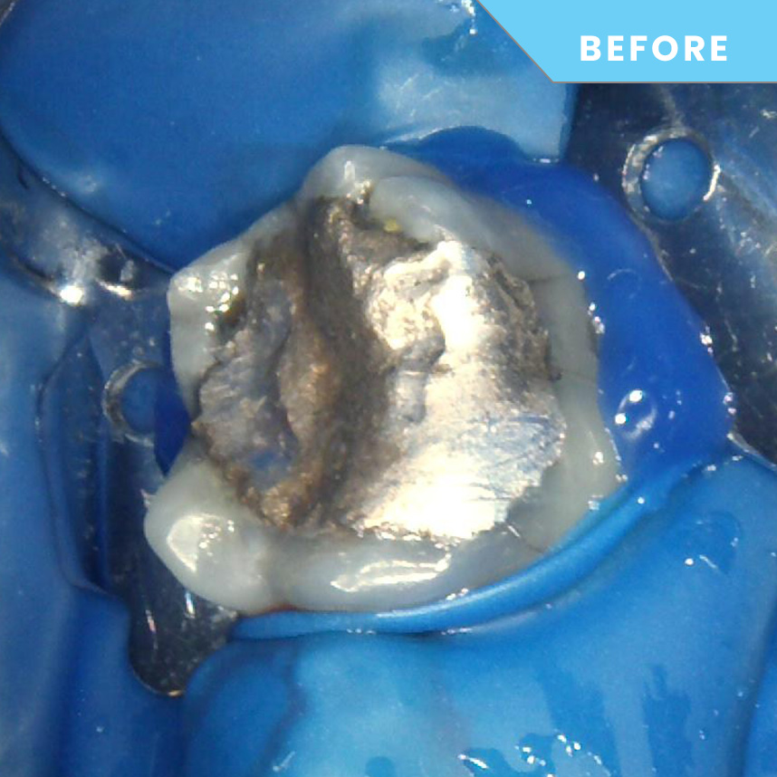 After treatment – Case 03
