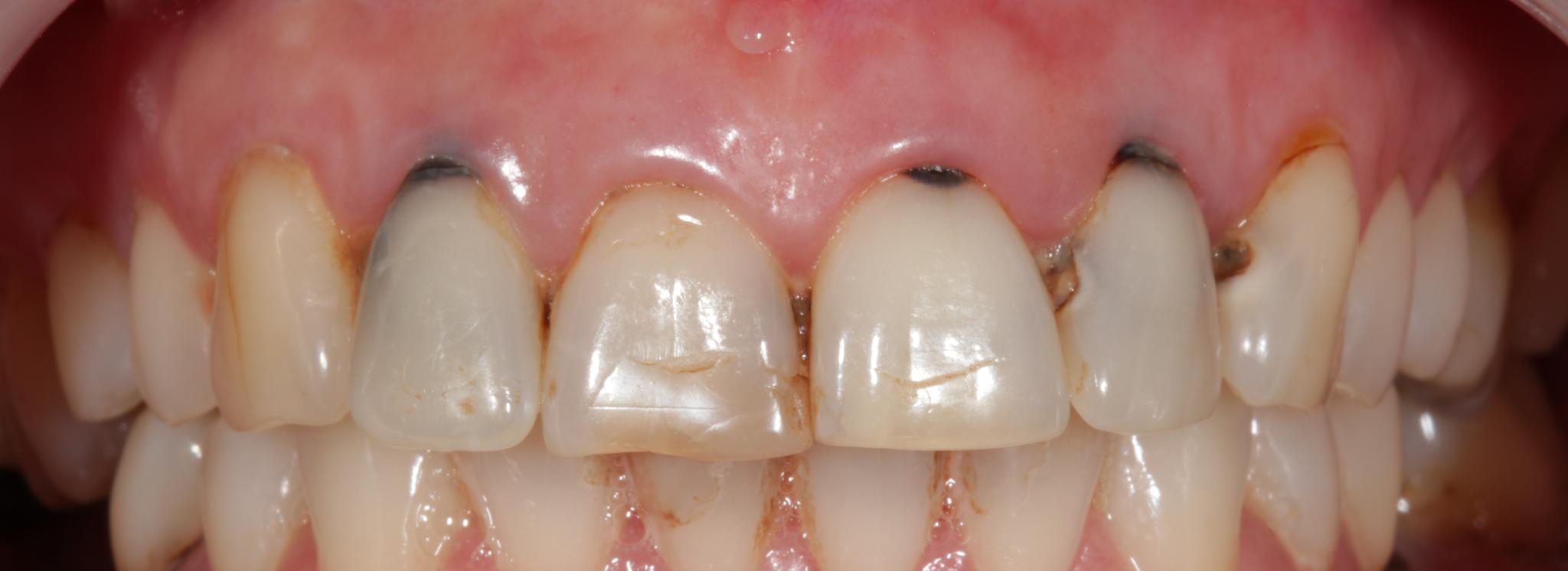 Before treatment – Case 10