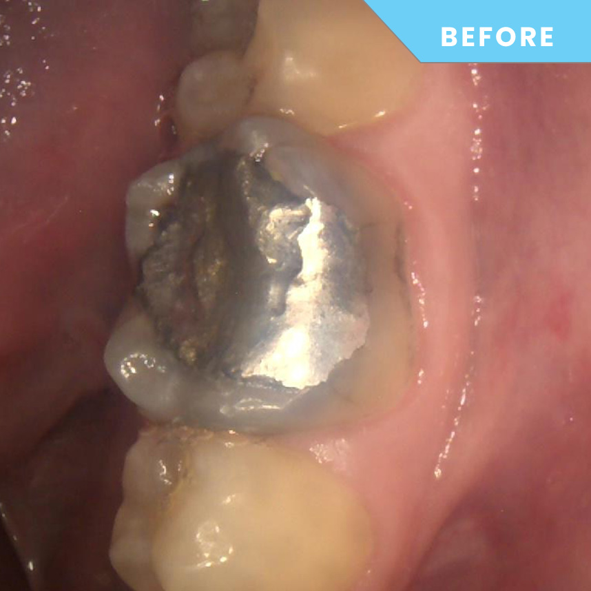 Before treatment – Case 03