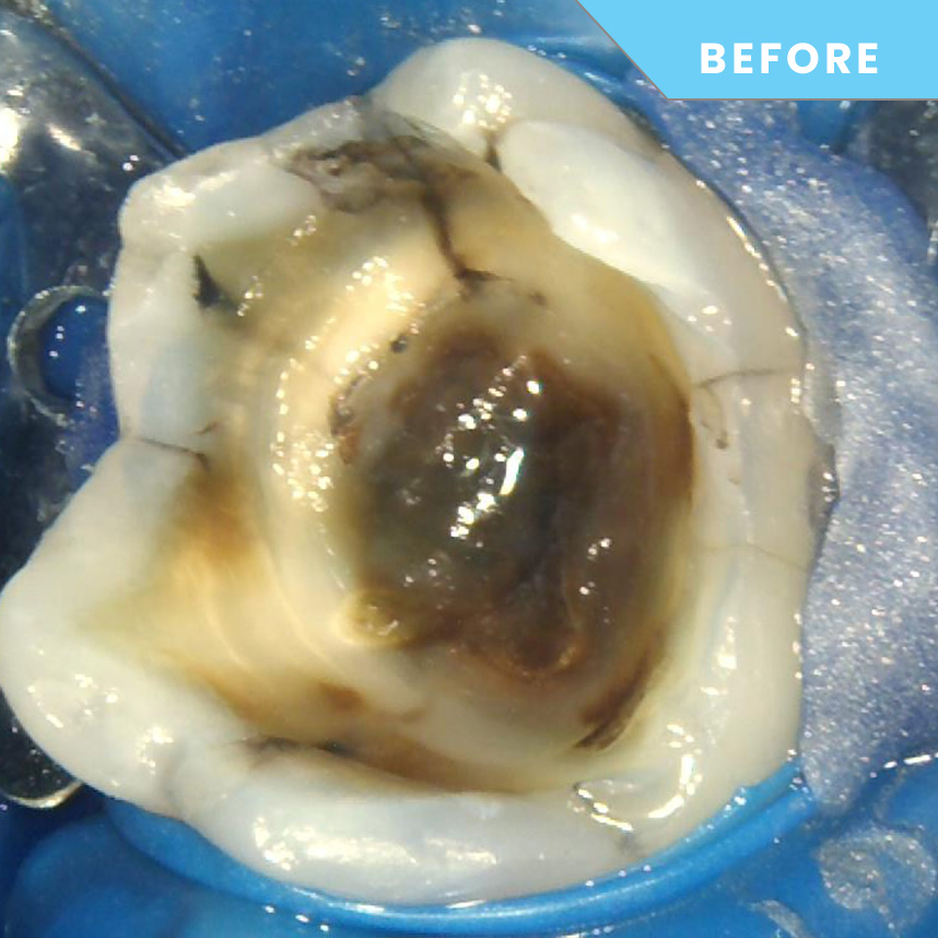 Before treatment – Case 04