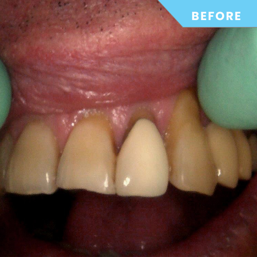Before treatment – Case 07