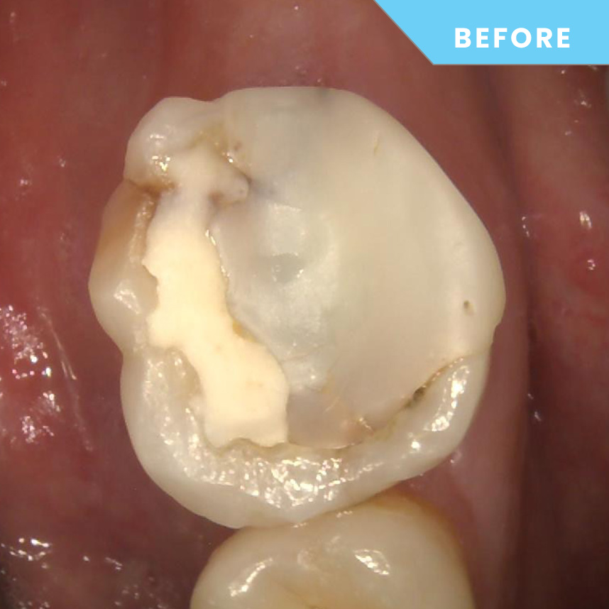 Before treatment – Case 08