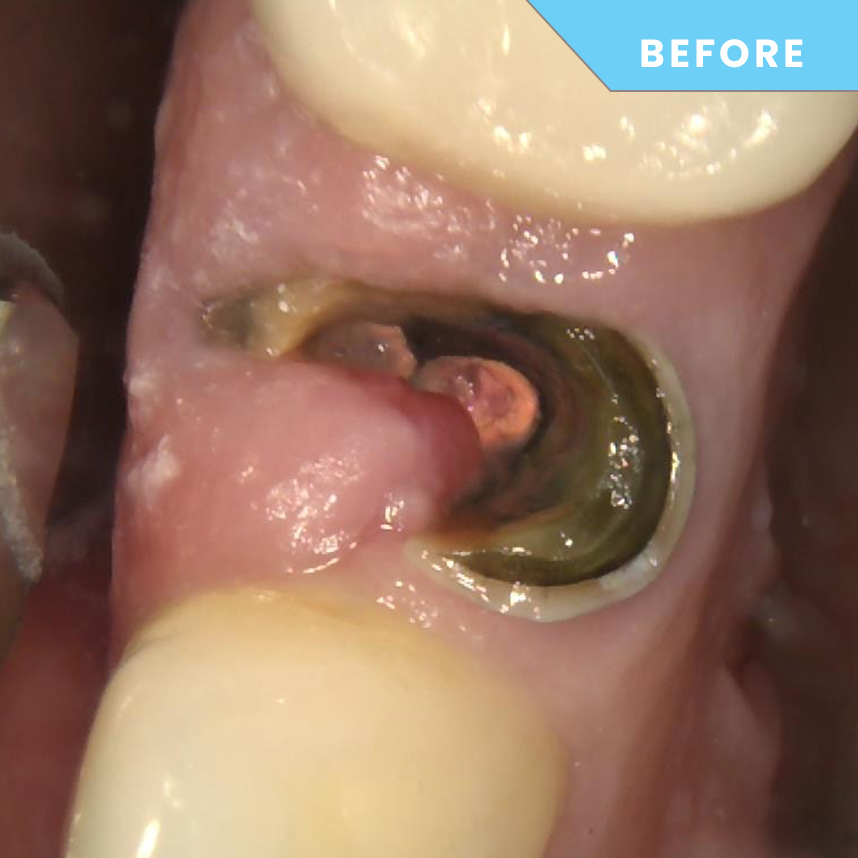 Before treatment – Case 09