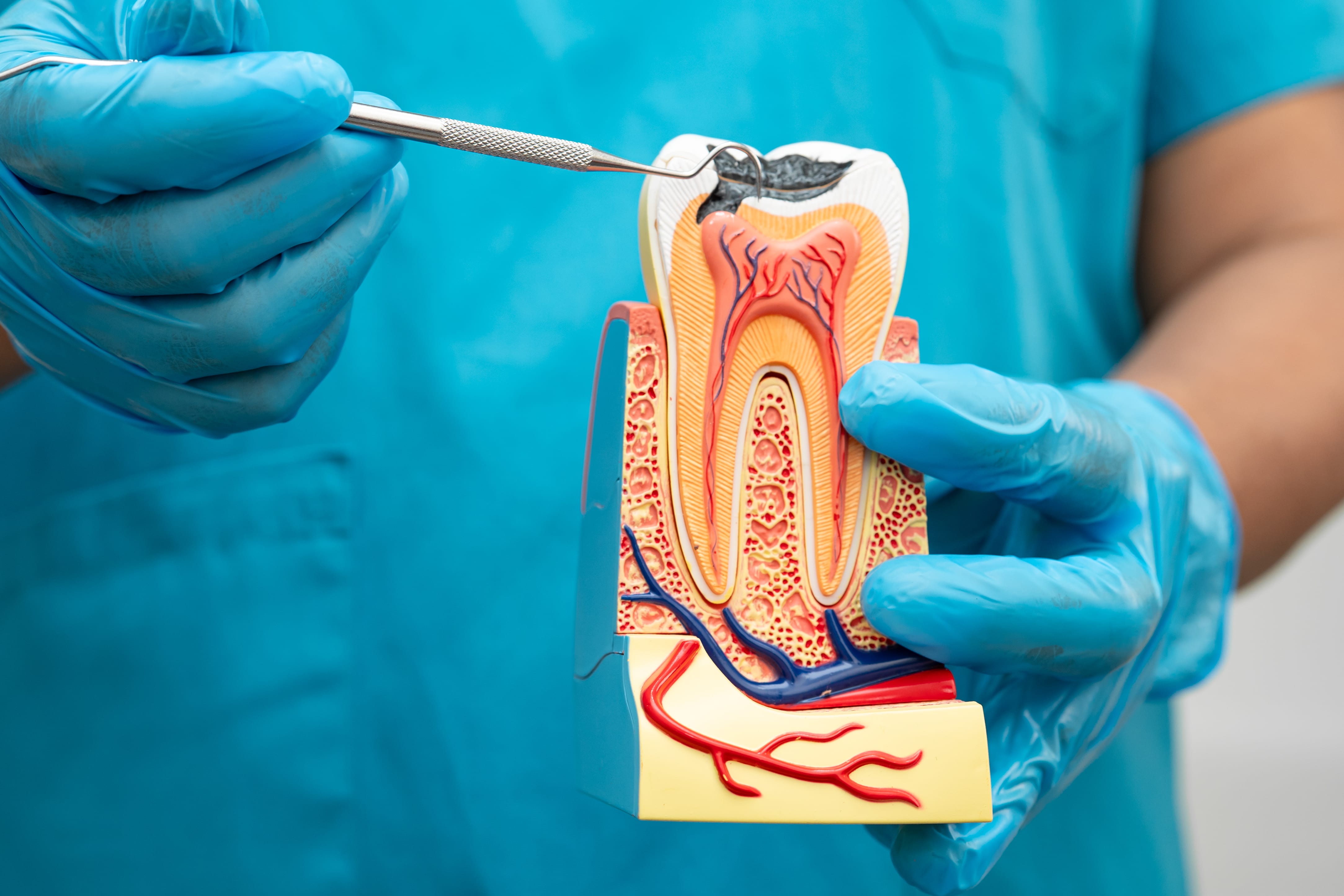 Root Canal Treatment – Dentist Cape Town